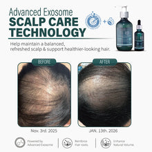 Load image into Gallery viewer, SH-RD EXOSOME Scalp Revival Shampoo (6.76oz/200ml)