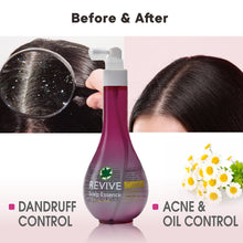 Load image into Gallery viewer, Revive Scalp Essence
