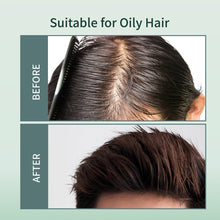 Load image into Gallery viewer, Scalp Purifying Essentials
